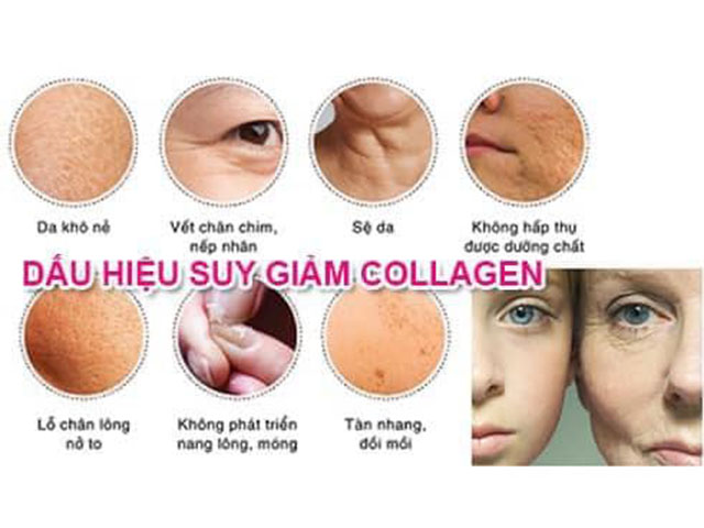 Thiếu hụt Collagen gây nên các tổn thương trên da